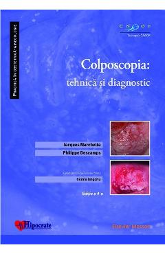 Colposcopia: tehnica si diagnostic - Jacques Marchetta, Philippe Descamps, Corina Grigoriu