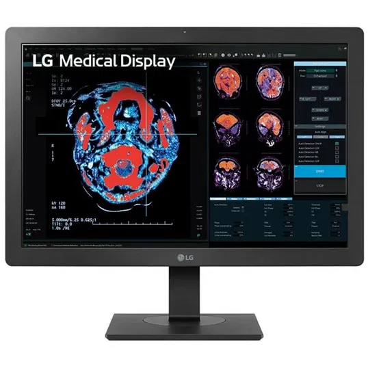 Monitor LG 24 24HR513C-B.AEU