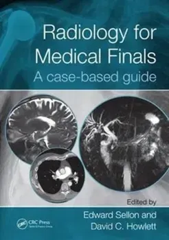 Radiology for Medical Finals. A case-based guide, Paperback - ***