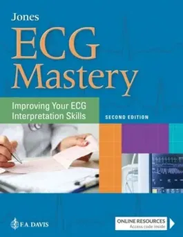 ECG Mastery. Improving Your ECG Interpretation Skills, Paperback - Shirley A. Jones